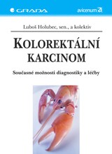 E-kniha Kolorektální karcinom - Luboš Holubec