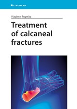 E-kniha Treatment of calcaneal fractures - Vladimír Popelka