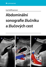 E-kniha Abdominální sonografie žlučníku a žlučových cest - Iva Hoffmanová