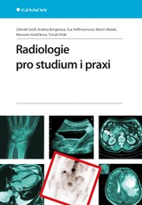 E-kniha Radiologie pro studium i praxi - Zdeněk Seidl, Eva Hoffmannová, Andrea Burgetová