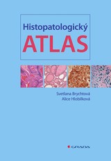 E-kniha Histopatologický atlas - Alice Hlobilková, Svetlana Brychtová