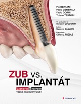 E-kniha Zub vs. implantát - kolektiv a, Pio Bertani, Paolo Generali, Fabio Gorni, Tiziano Testori