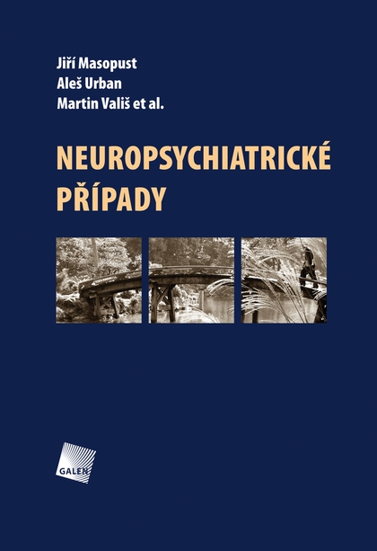 E-kniha Neuropsychiatrické případy - Jiří Masopust, Aleš Urban, Martin Vališ