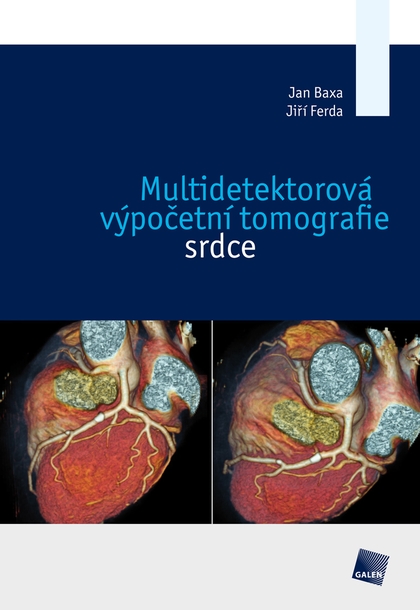 E-kniha Multidetektorová výpočetní tomografie srdce - Jan Baxa, Jiří Ferda