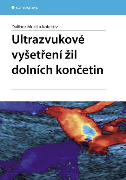 E-kniha Ultrazvukové vyšetření žil dolních končetin - kolektiv a, Dalibor Musil