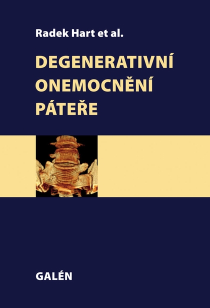 E-kniha Degenerativní onemocnění páteře -  et al., Radek Hart