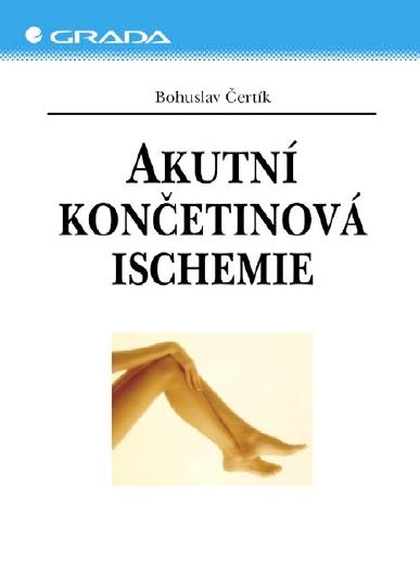 E-kniha Akutní končetinová ischemie - Bohuslav Čertík