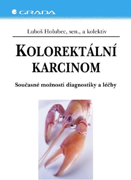 E-kniha Kolorektální karcinom - kolektiv a, Luboš Holubec
