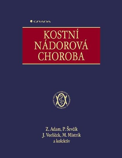 E-kniha Kostní nádorová choroba - Jiří Vorlíček, Pavel Ševčík, kolektiv a, Zdeněk Adam, Martin Mistrík