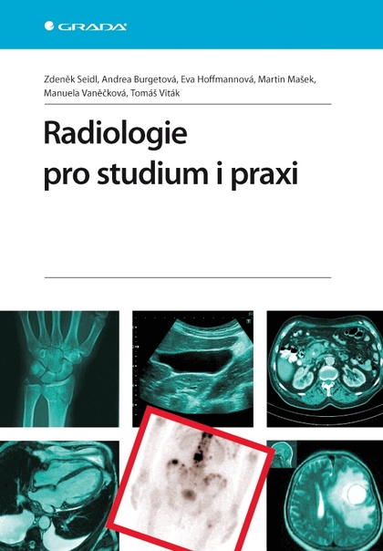 E-kniha Radiologie pro studium i praxi - Zdeněk Seidl, Andrea Burgetová, Eva Hoffmannová, Martin Mašek, Manuela Vaněčková, Tomáš Viták