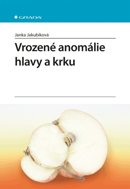 E-kniha Vrozené anomálie hlavy a krku - Janka Jakubíková