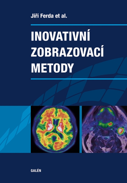 E-kniha Inovativní zobrazovací metody - Jiří Ferda,  at al.