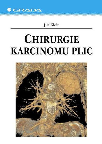 E-kniha Chirurgie karcinomu plic - Jiří Klein