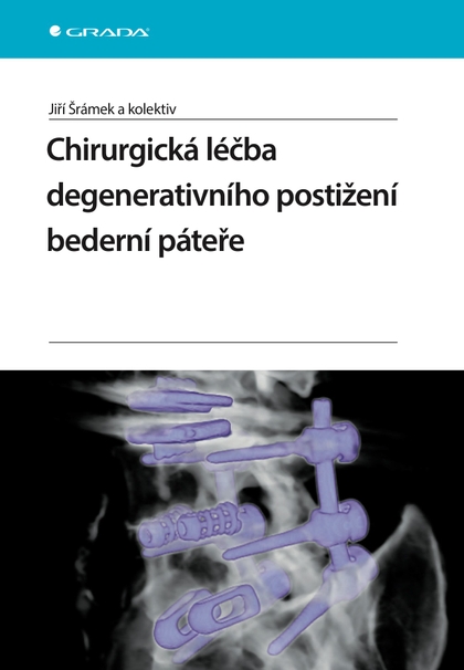 E-kniha Chirurgická léčba degenerativního postižení bederní páteře - Jiří Šrámek, kolektiv a