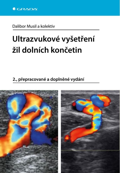 E-kniha Ultrazvukové vyšetření žil dolních končetin - kolektiv a, Dalibor Musil