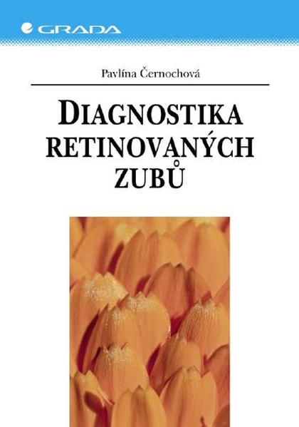 E-kniha Diagnostika retinovaných zubů - Pavlína Černochová