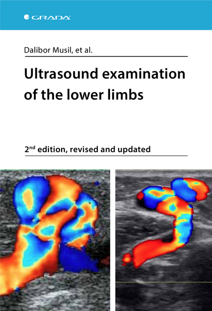 E-kniha Ultrasound examination of the lower limbs - Dalibor et al. Musil