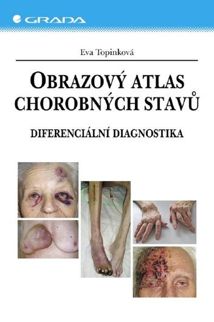 E-kniha Obrazový atlas chorobných stavů - Eva Topinková
