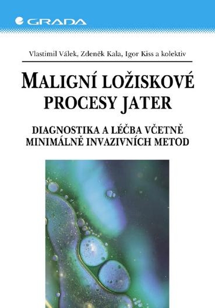 E-kniha Maligní ložiskové procesy jater - kolektiv a, Zdeněk Kala, Igor Kiss, Vlastimil Válek