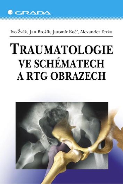 E-kniha Traumatologie ve schématech a RTG obrazech - Alexander Ferko, Ivo Žvák, Jan Brožík, Jaromír Kočí