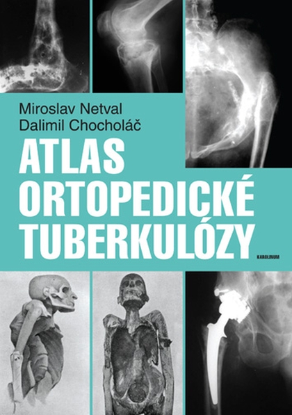 E-kniha Atlas ortopedické tuberkulózy - Miroslav Netval, Dalimil Chocholáč