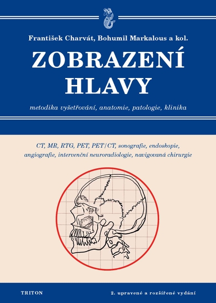 E-kniha Zobrazení hlavy - a kolektiv, František Charvát, MUDr. Bohumil Markalous