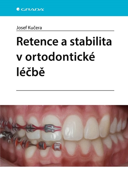 E-kniha Retence a stabilita v ortodontické léčbě - Josef Kučera