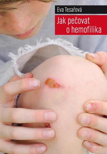 E-kniha Jak pečovat o hemofilika - MUDr. Eva Tesařová