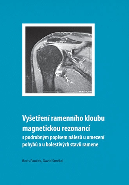 E-kniha Vyšetření ramenního kloubu magnetickou rezonancí s podrobným popisem nálezů u omezení pohybů u bolestivých stavů ramene - Boris Pauček, David Smékal