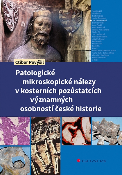E-kniha Patologické mikroskopické nálezy v kosterních pozůstatcích významných osobností české historie - Ctibor Povýšil