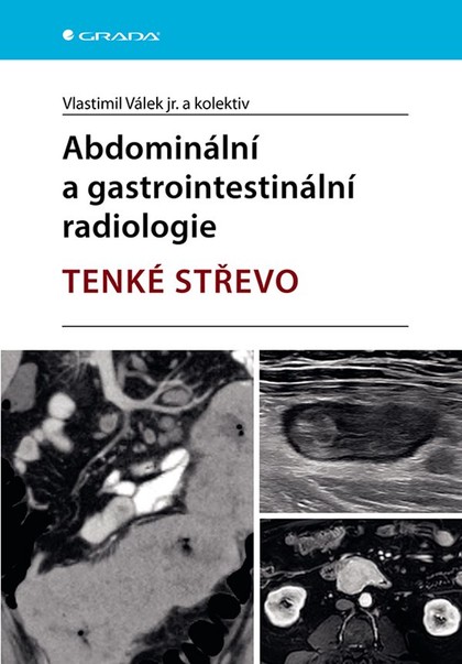 E-kniha Abdominální a gastrointestinální radiologie - kolektiv a, jr. Vlastimil Válek