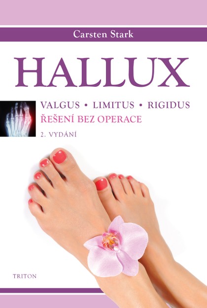 E-kniha Hallux - Carsten Stark