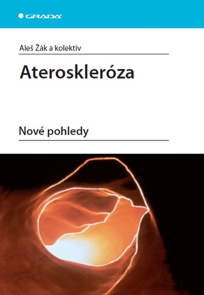 E-kniha Ateroskleróza - Aleš Žák, kolektiv a