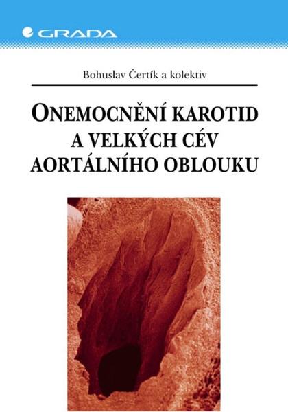 E-kniha Onemocnění karotid a velkých cév aortálního oblouku - kolektiv a, Bohuslav Čertík