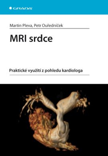 E-kniha MRI srdce - Petr Ouředníček, Martin Pleva
